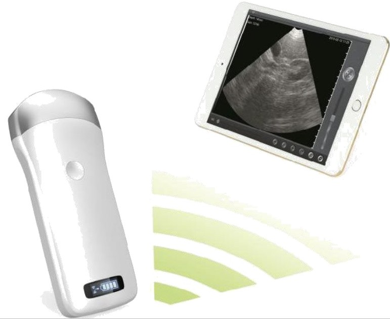 Wireless Ultrasound Probe