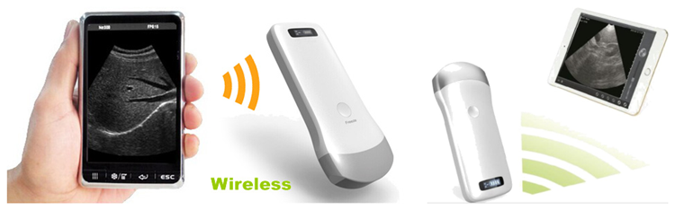 Wireless Ultrasound Probe